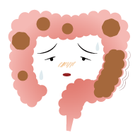 弛緩性便秘の腸