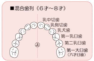 混合歯列