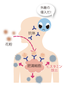 花粉症のしくみ