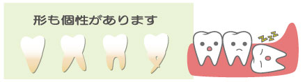 親知らずの根っこはいろいろ