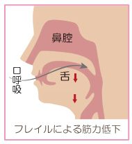 フレイルによる筋力低下