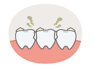 歯垢べったりの歯