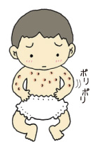 とびひで水泡をかきむしる赤ちゃん