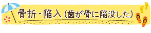 骨折・陥入（歯が骨に陥没した）