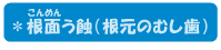 ＊根面う蝕（根元のむし歯）