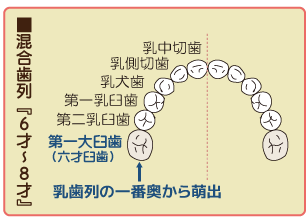 混合歯列