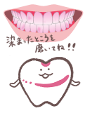 染め出し検査